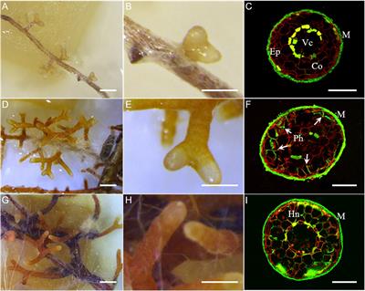 Transcriptome Profiling Reveals Differential Gene Expression of Secreted Proteases and Highly Specific Gene Repertoires Involved in <mark class="highlighted">Lactarius</mark>–Pinus Symbioses